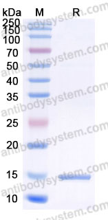 YHD41803, SDS-PAGE