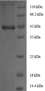 SDS-PAGE