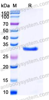 AHA05601, SDS-PAGE