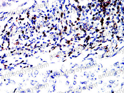 Валидация AntibodySystem RHC91003 (1168)