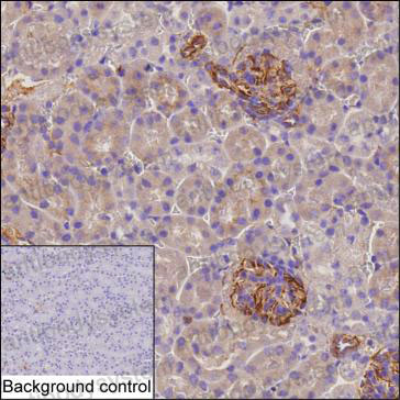 Валидация AntibodySystem RHF66402
