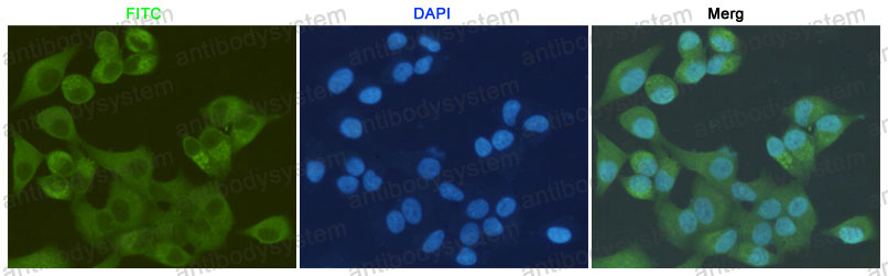 Валидация IF - AntibodySystem RMF38601