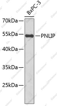 Вестерн-блоттинг, PNLIP, клетки BxPC-3