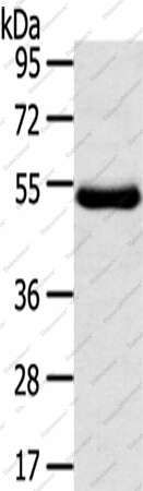Вестерн-блоттинг, TMPRSS11D, ткань злокачественной фиброзной гистиоцитомы бедра человека