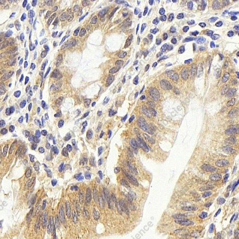 Иммуногистохимия, CDC25A, ткань толстой кишки человека