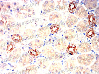 Валидация AntibodySystem RHH16101