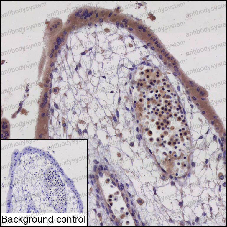 Валидация AntibodySystem RHP07602