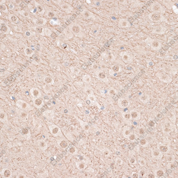 Иммуногистохимия, VEGF Receptor 2, ткань мозга мыши