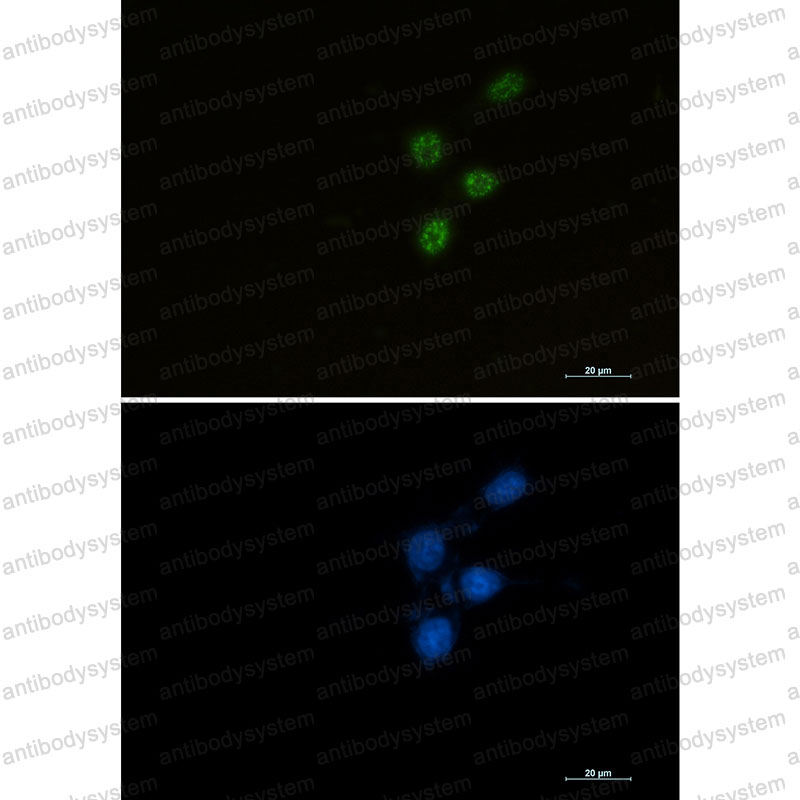 Валидация IF - AntibodySystem RHB83802