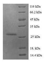 SDS-PAGE