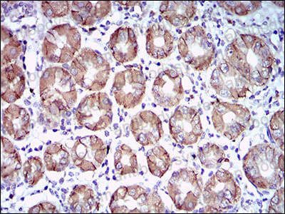 Валидация AntibodySystem RHH37204