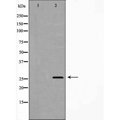 Валидация Affinity DF6993 - 18633