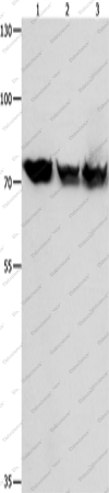 Вестерн-блоттинг, HSP75, клетки K562, Jurkat, 293T