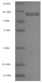 SDS-PAGE