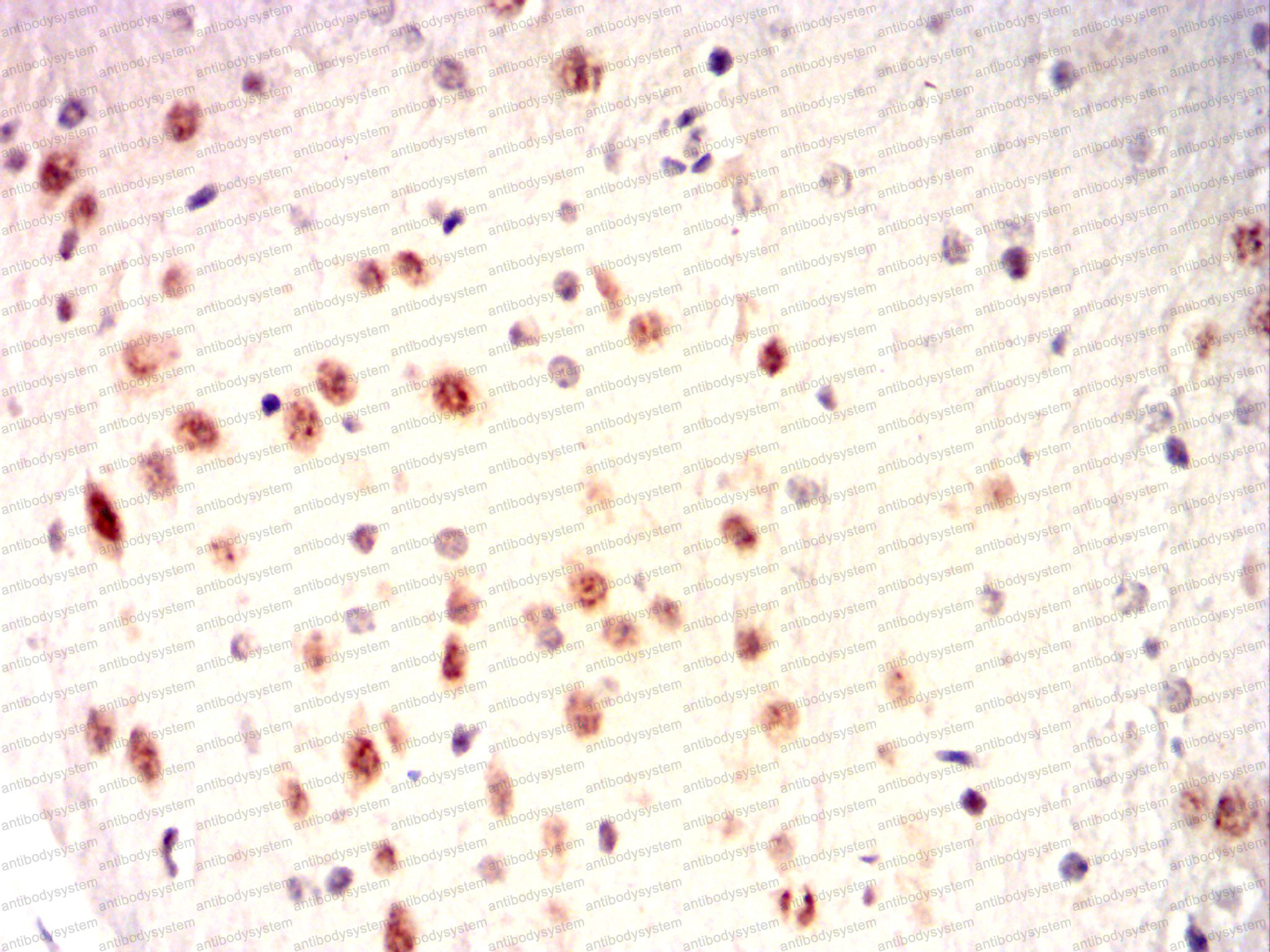 Валидация AntibodySystem RHF42903 (2512)