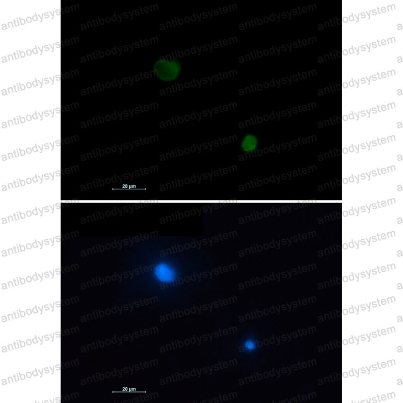 Валидация IF - AntibodySystem RHD67202