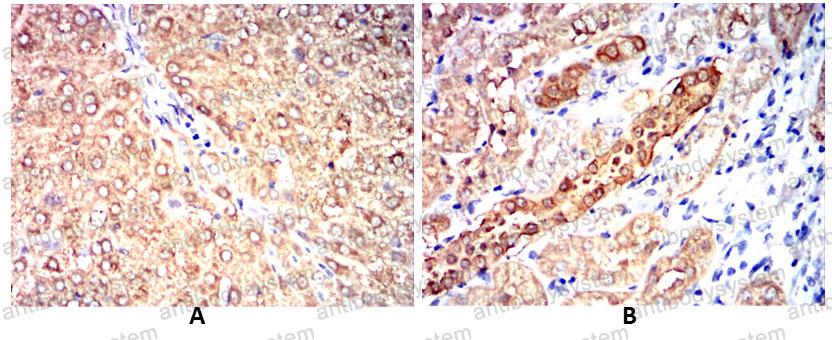 Валидация AntibodySystem RHC12802