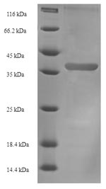 SDS-PAGE