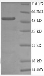 SDS-PAGE