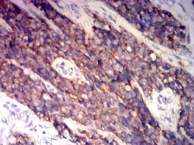 Валидация AntibodySystem RHD03606 (1291)