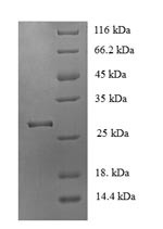 SDS-PAGE