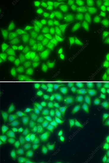 Иммунофлуоресценция, METTL2A, клетки MCF-7