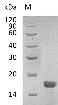 SDS-PAGE
