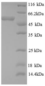SDS-PAGE