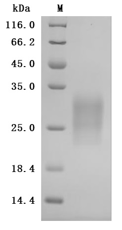 SDS-PAGE