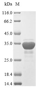SDS-PAGE