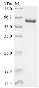 SDS-PAGE