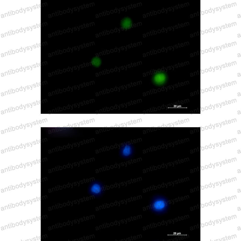Валидация IF - AntibodySystem RHD14401