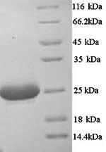 SDS-PAGE