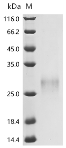 SDS-PAGE