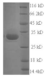 SDS-PAGE