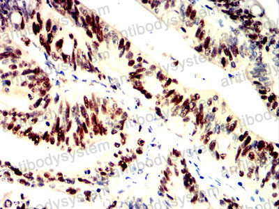 Валидация AntibodySystem RHD66502