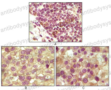 Валидация AntibodySystem RHC13402