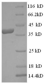 SDS-PAGE