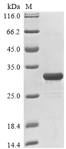 SDS-PAGE