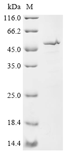 SDS-PAGE