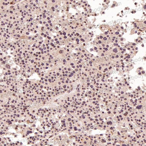 Валидация AntibodySystem RHN60301 (3840)