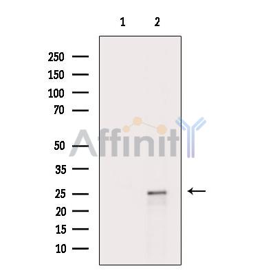 Валидация Affinity DF9044 - 21290