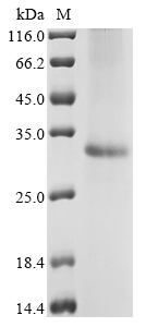 SDS-PAGE