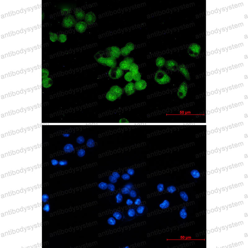 Валидация IF - AntibodySystem RHF59701