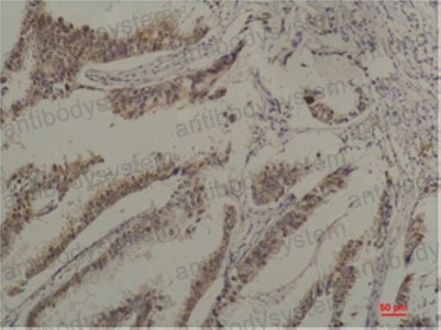 Валидация AntibodySystem RHC85602