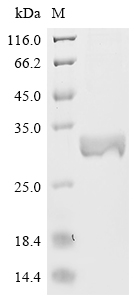 SDS-PAGE