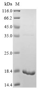 SDS-PAGE