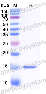 Валидация SDS-PAGE - AntibodySystem RWK25802