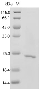 SDS-PAGE