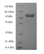 SDS-PAGE